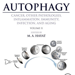 Autophagy: Cancer