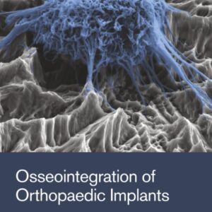 Osseointegration of Orthopaedic Implants