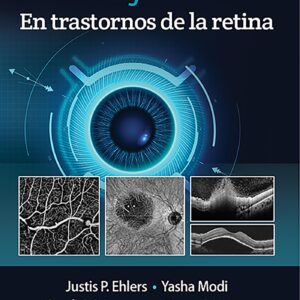 OCT y OCTA en trastornos de la retina (Spanish Edition)-ISBN: 9788418563126