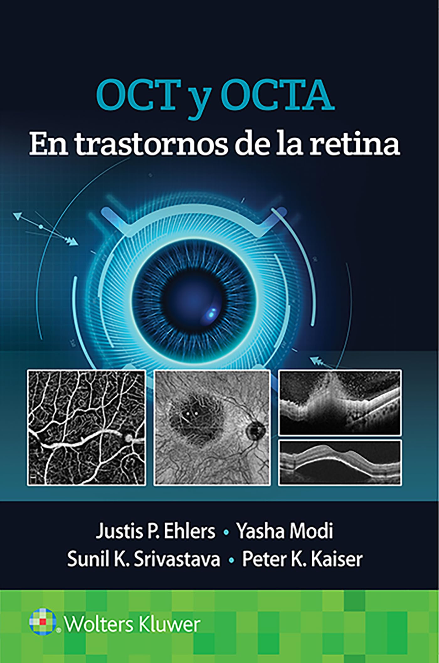 OCT y OCTA en trastornos de la retina (Spanish Edition)-ISBN: 9788418563126