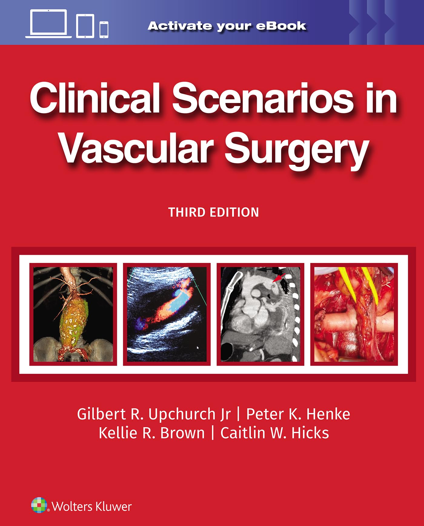 Clinical Scenarios in Vascular Surgery-ISBN: 9781975216238
