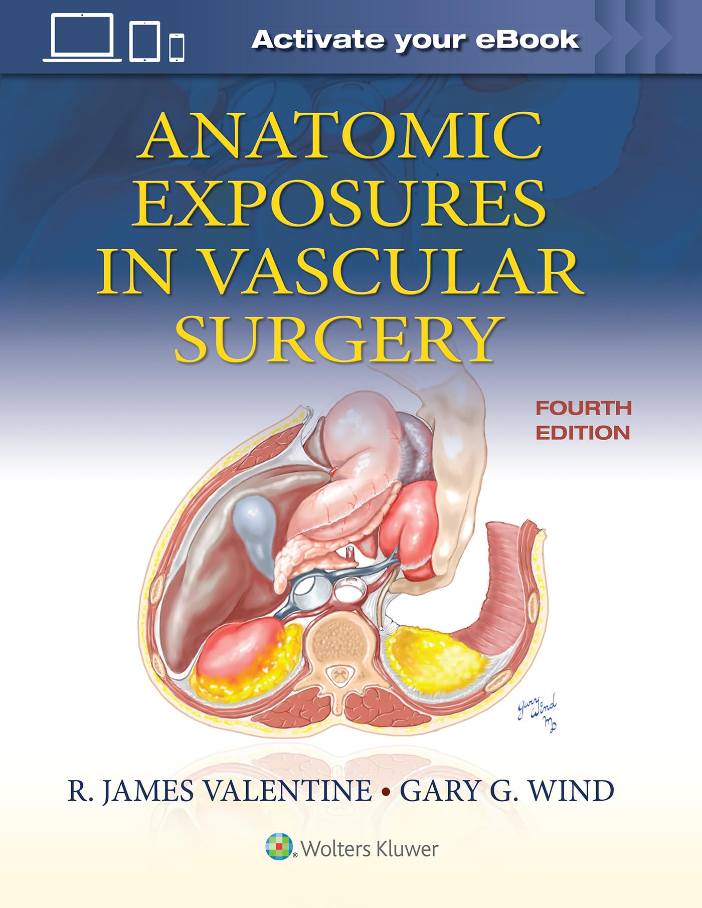 Anatomic Exposures in Vascular Surgery-ISBN: 9781975152765