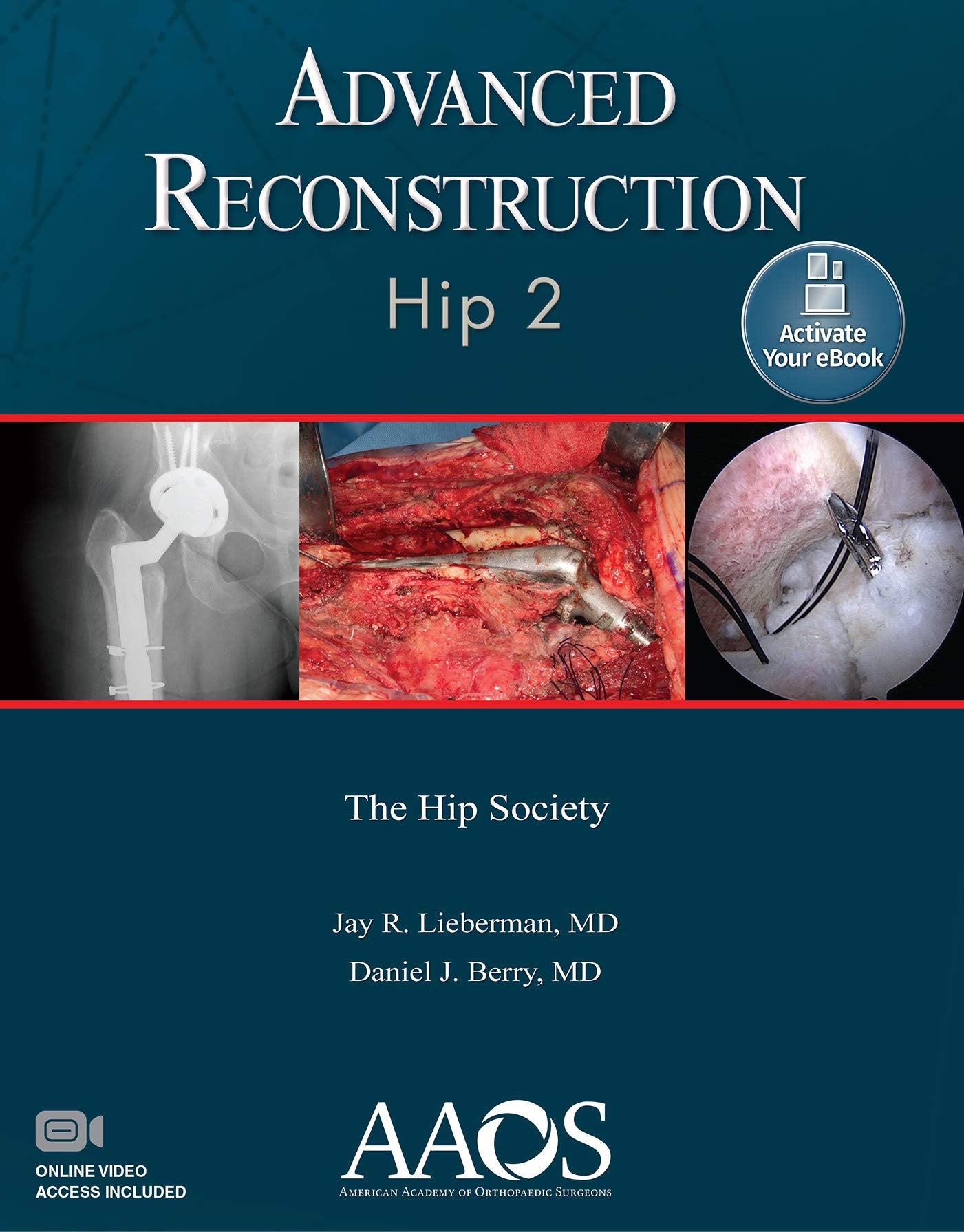 Advanced Reconstruction: Hip 2: Print + Ebook with Multimedia (AAOS - American Academy of Orthopaedic Surgeons)-ISBN: 9781975123833
