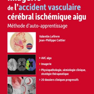 Imagerie de l'accident vasculaire cérébral ischémique aigu: Méthode d'auto-apprentissage