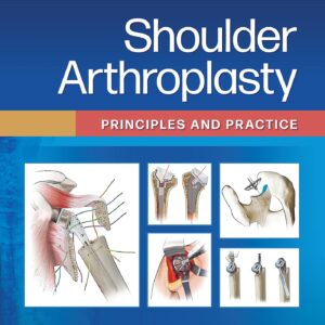 Shoulder Arthroplasty: Principles and Practice-ISBN: 9781975157661