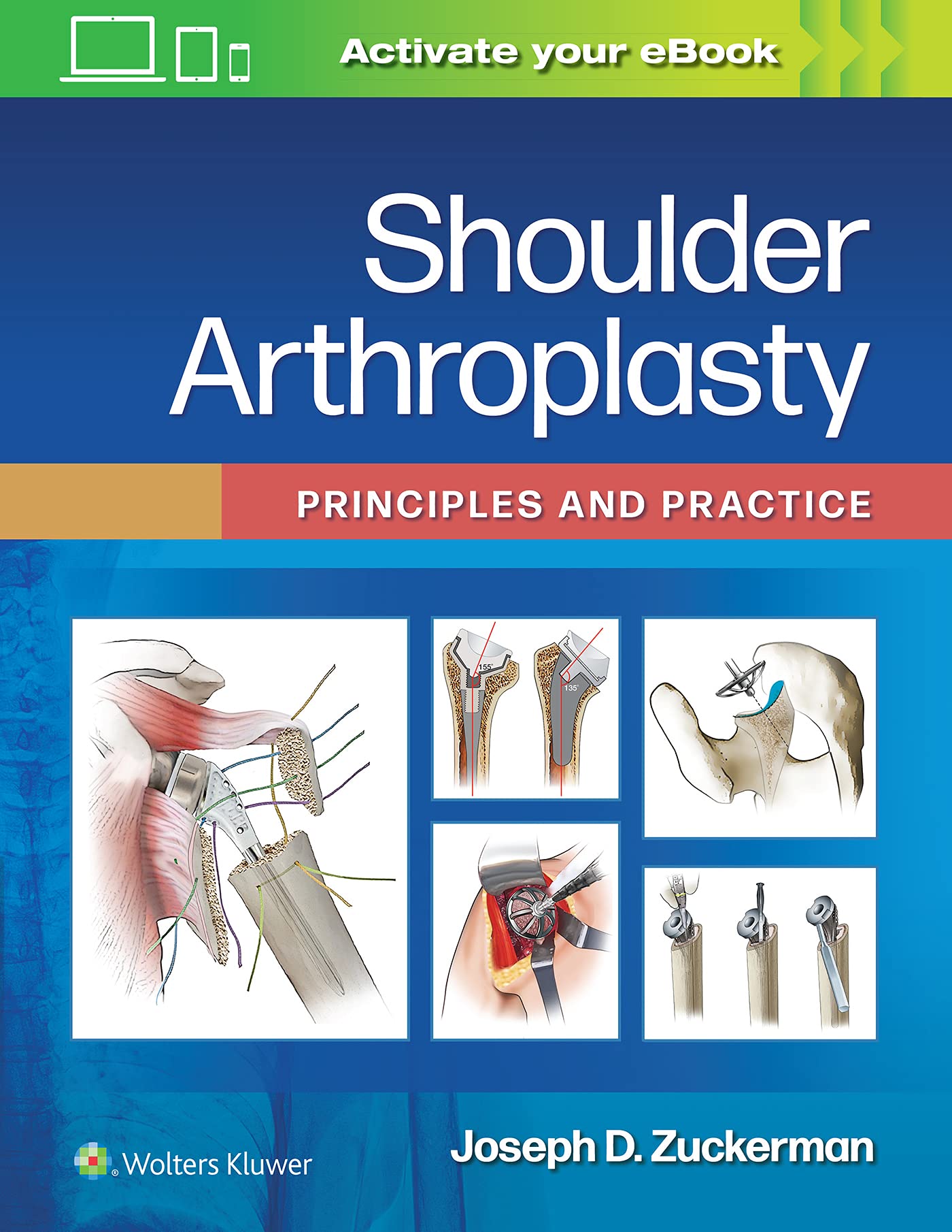 Shoulder Arthroplasty: Principles and Practice-ISBN: 9781975157661
