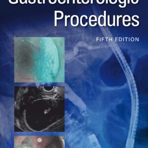 Handbook of Gastroenterologic Procedures (Lippincott Williams & Wilkins Handbook Series)-ISBN: 9781975111656