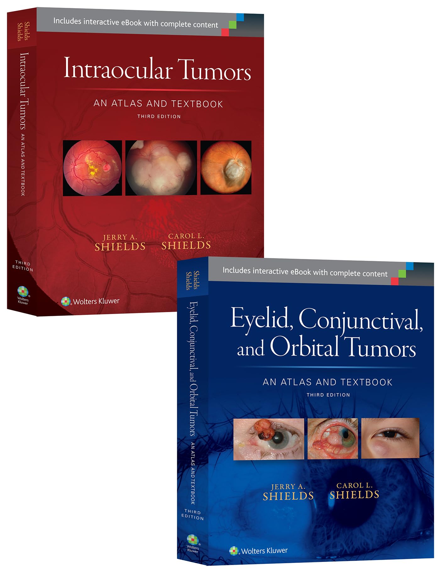 Shields: Intraocular Tumors 3e and Eyelid
