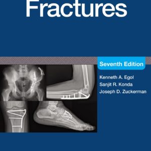 Handbook of Fractures: Print + eBook with Multimedia-ISBN: 9781975217990