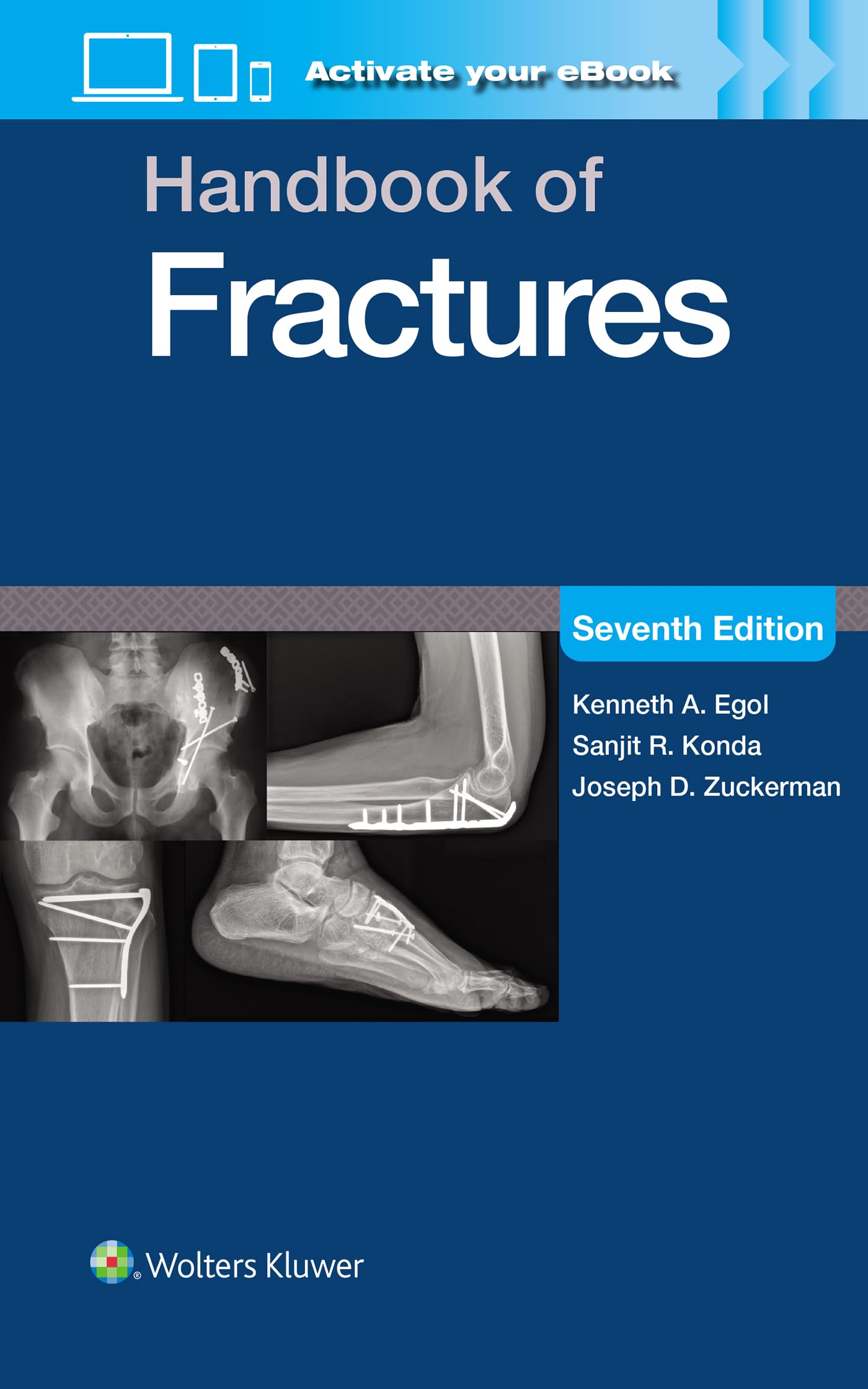 Handbook of Fractures: Print + eBook with Multimedia-ISBN: 9781975217990
