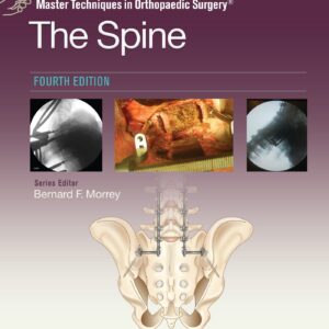 Master Techniques in Orthopaedic Surgery: The Spine-ISBN: 9781975175511
