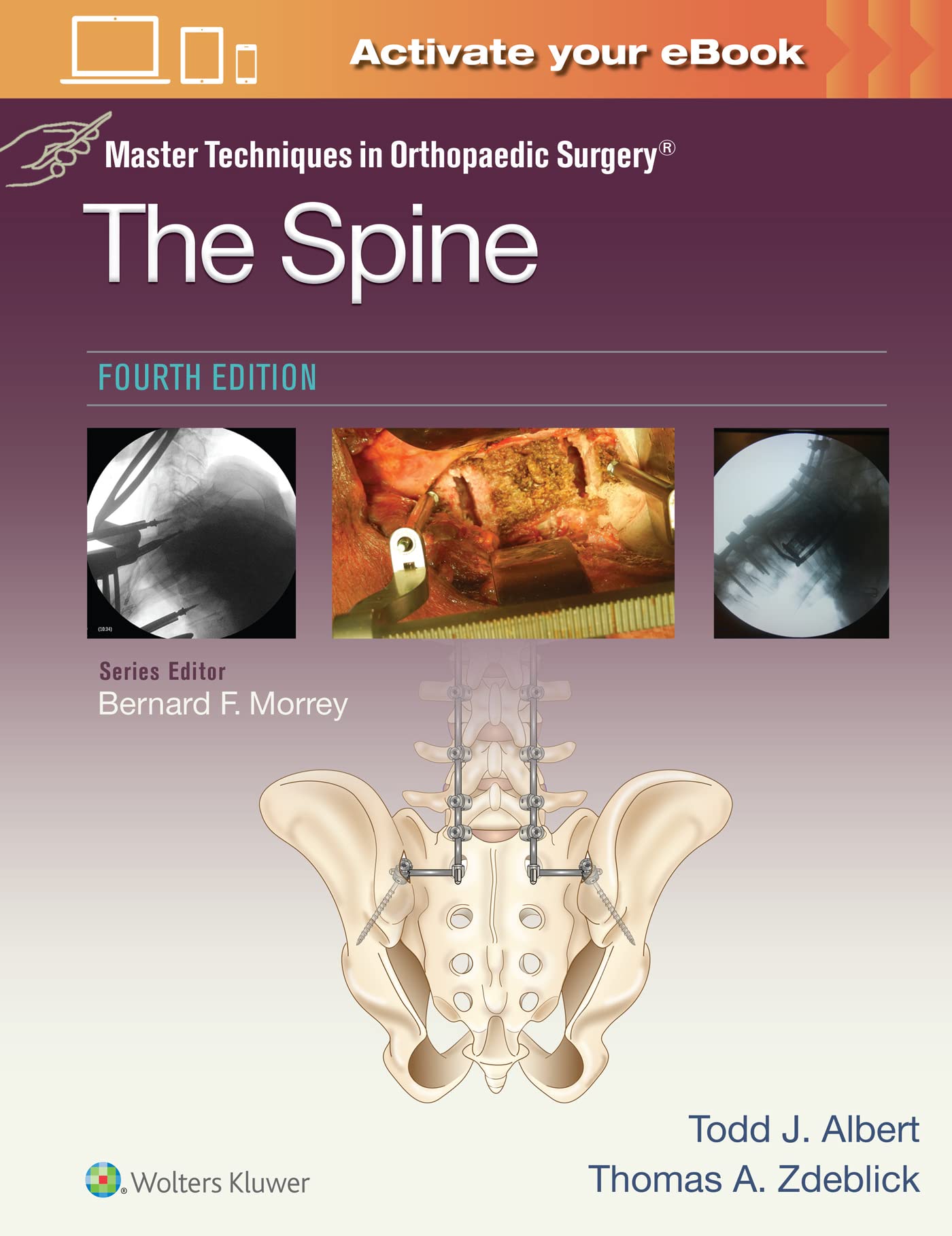 Master Techniques in Orthopaedic Surgery: The Spine-ISBN: 9781975175511
