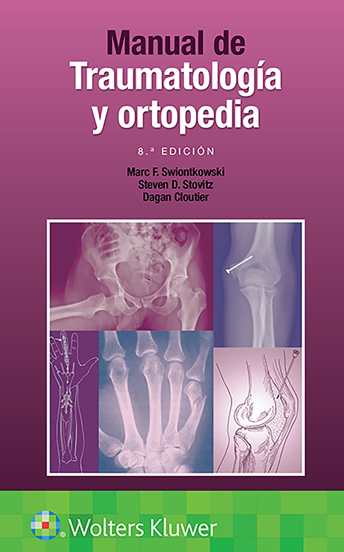 Manual de traumatologÃa y ortopedia (Spanish Edition)-ISBN: 9788418563355