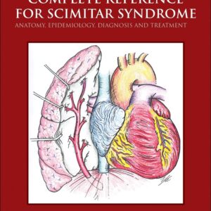 The Complete Reference for Scimitar Syndrome: Anatomy