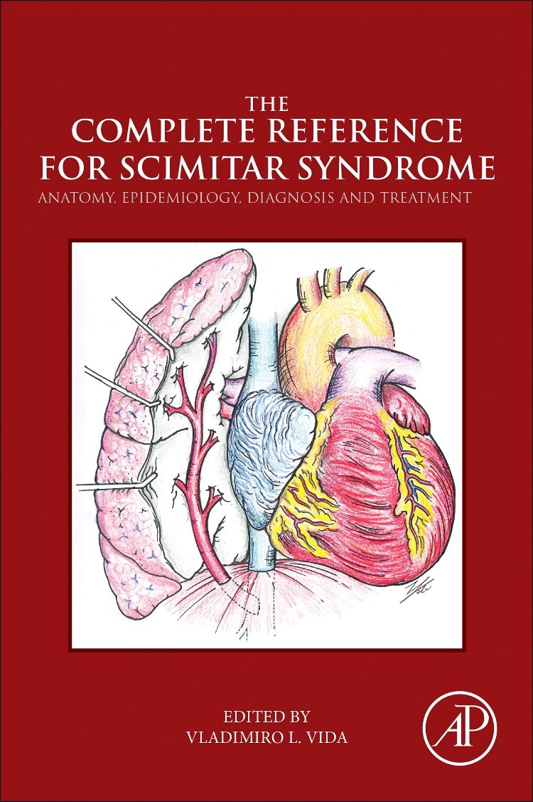 The Complete Reference for Scimitar Syndrome: Anatomy