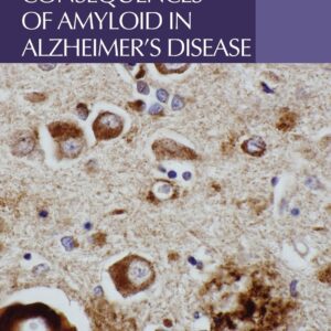 Intracellular Consequences of Amyloid in Alzheimer's Disease