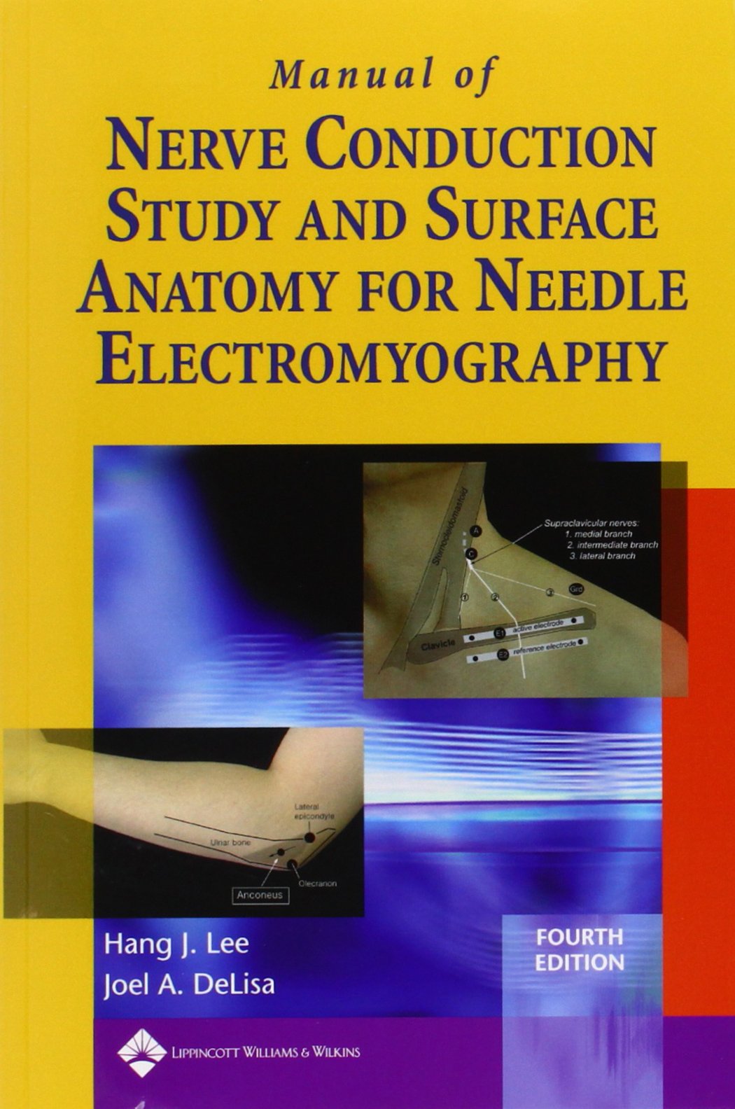 Manual of Nerve Conduction Study and Surface Anatomy for Needle Electromyography-ISBN: 9780781758215