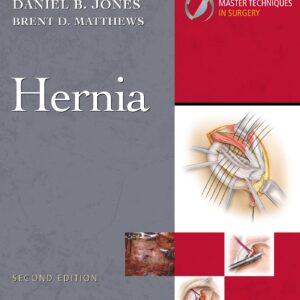 Master Techniques in Surgery: Hernia: Print + eBook with Multimedia-ISBN: 9781975222291