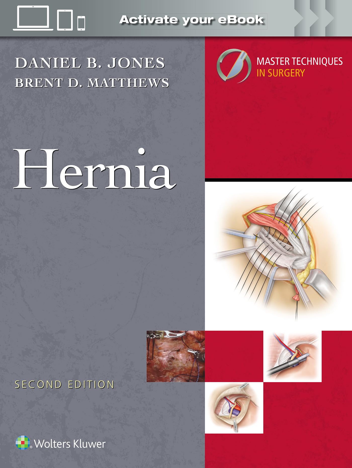 Master Techniques in Surgery: Hernia: Print + eBook with Multimedia-ISBN: 9781975222291