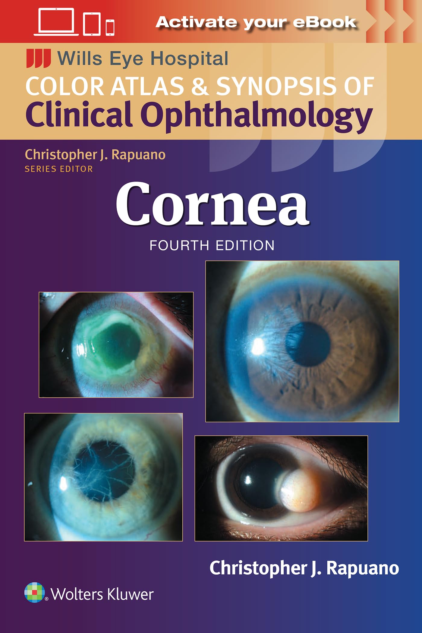 Cornea: Print + eBook with Multimedia (Wills Eye Institute Atlas Series)-ISBN: 9781975214975