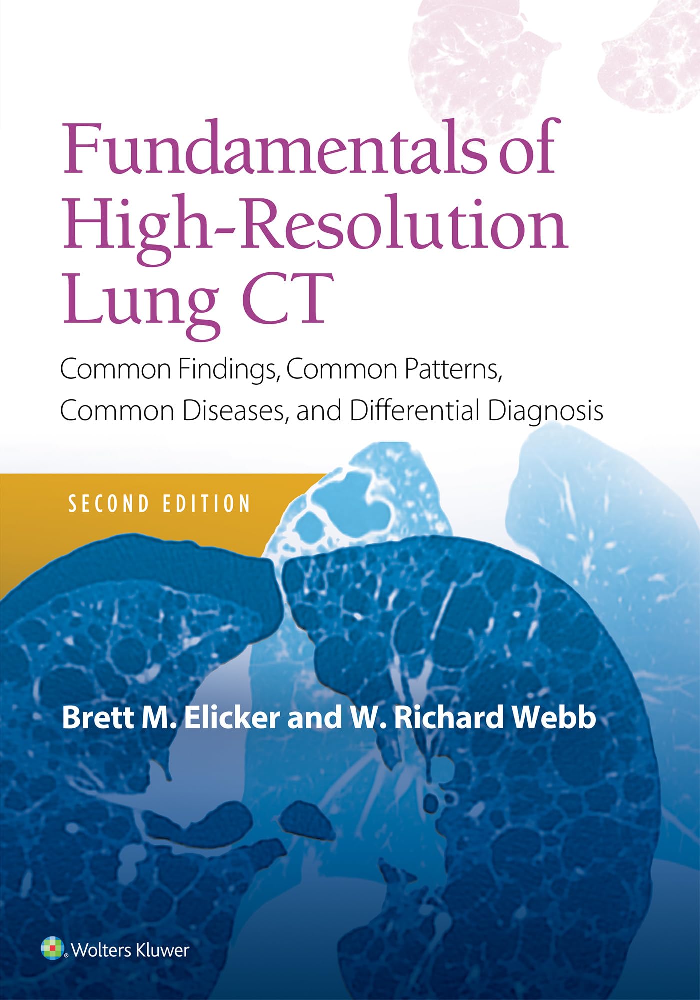 Fundamentals of High-Resolution Lung CT: Common Findings