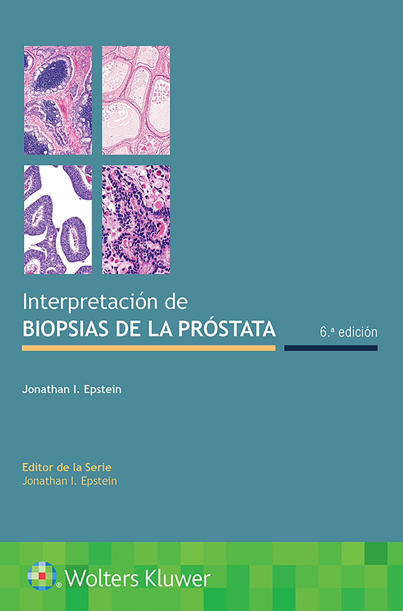 Interpretación de biopsias de la próstata (Spanish Edition)-ISBN: 9788418257285