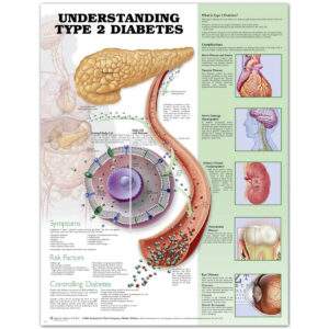Understanding Type 2 Diabetes Anatomical Chart-ISBN: 9781469894973