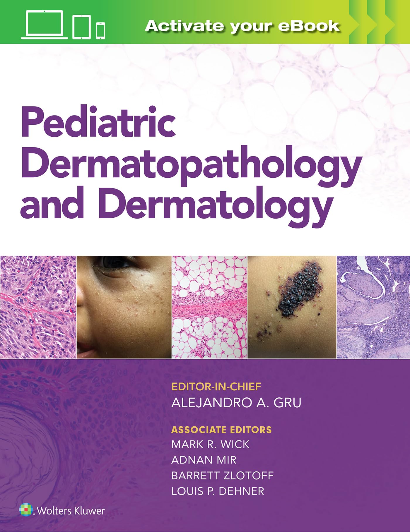 Pediatric Dermatopathology and Dermatology-ISBN: 9781496387851