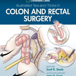 Cleveland Clinic Illustrated Tips and Tricks in Colon and Rectal Surgery-ISBN: 9781975108250