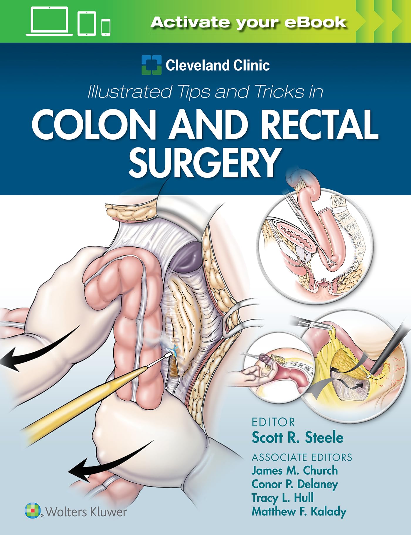 Cleveland Clinic Illustrated Tips and Tricks in Colon and Rectal Surgery-ISBN: 9781975108250