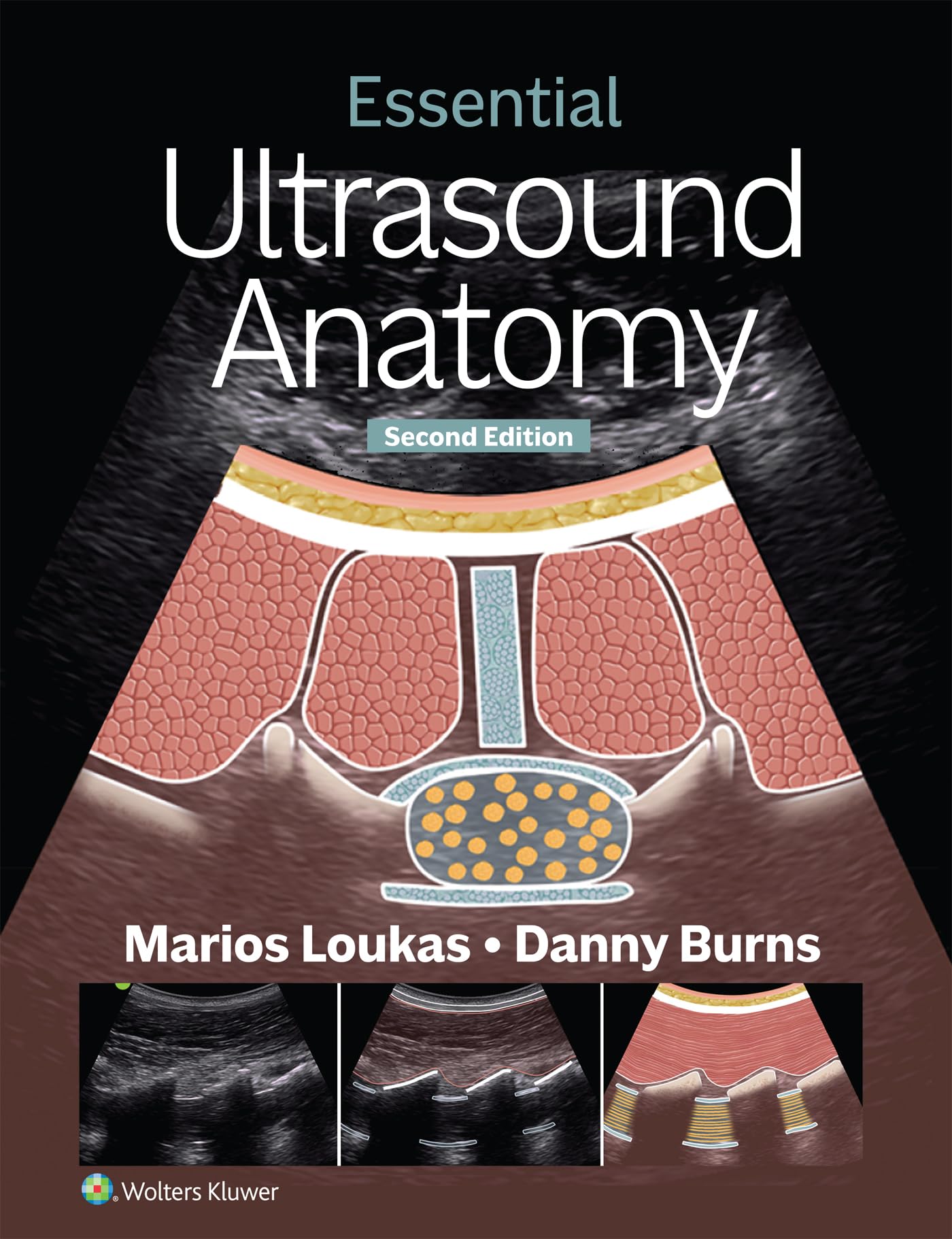 Essential Ultrasound Anatomy-ISBN: 9781975216887