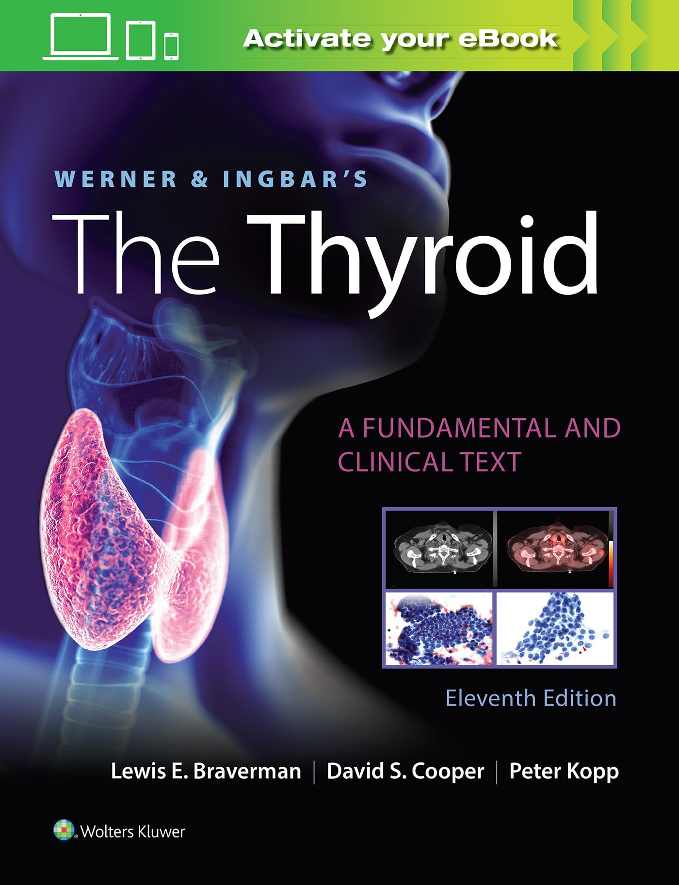 Werner & Ingbar's The Thyroid (Werner and Ingbars the Thyroid)-ISBN: 9781975112967