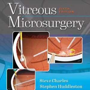 Vitreous Microsurgery-ISBN: 9781975168353