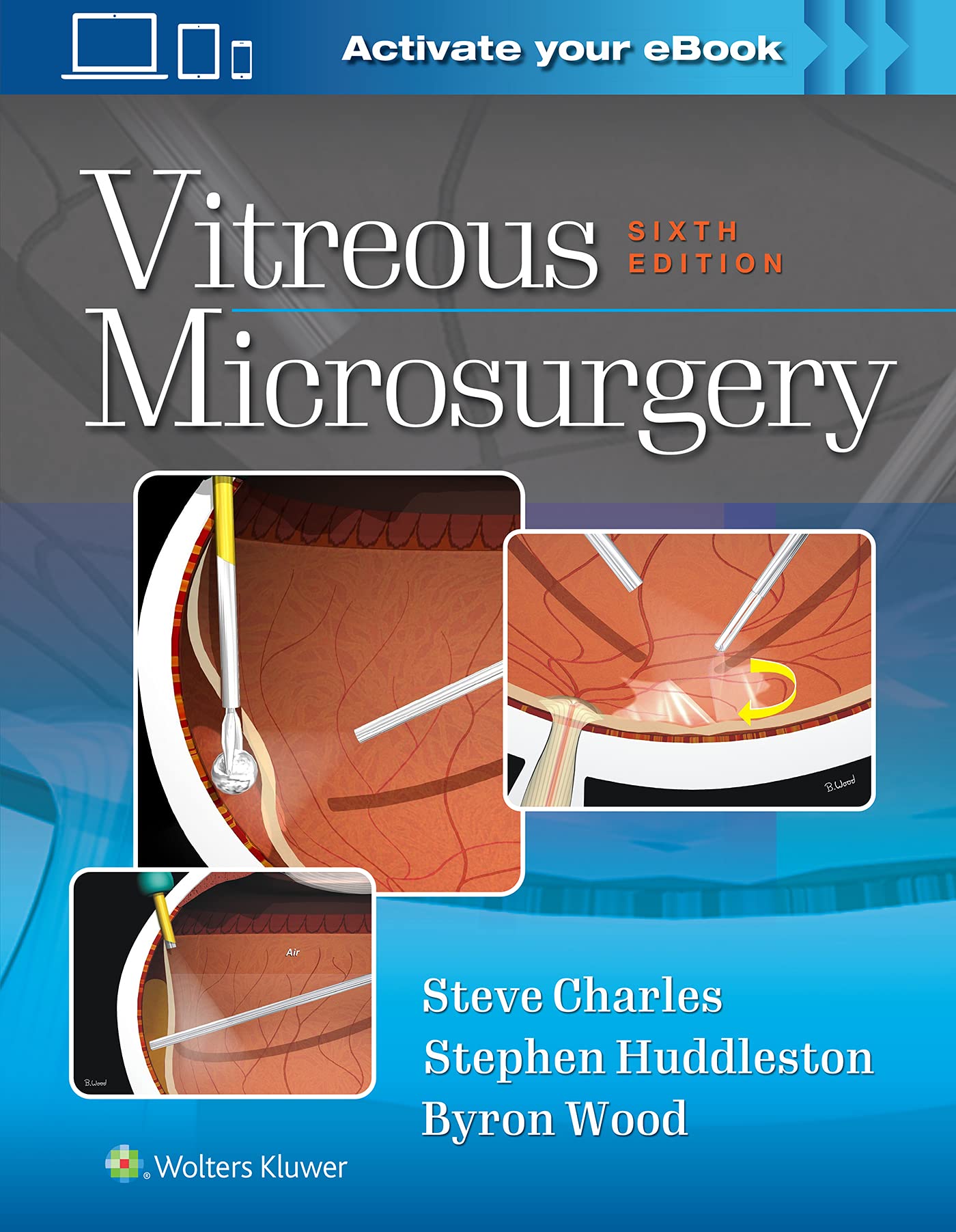 Vitreous Microsurgery-ISBN: 9781975168353