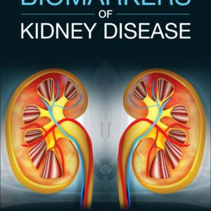 Biomarkers of Kidney Disease