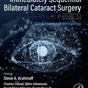 Immediately Sequential Bilateral Cataract Surgery (ISBCS): Global History and Methodology