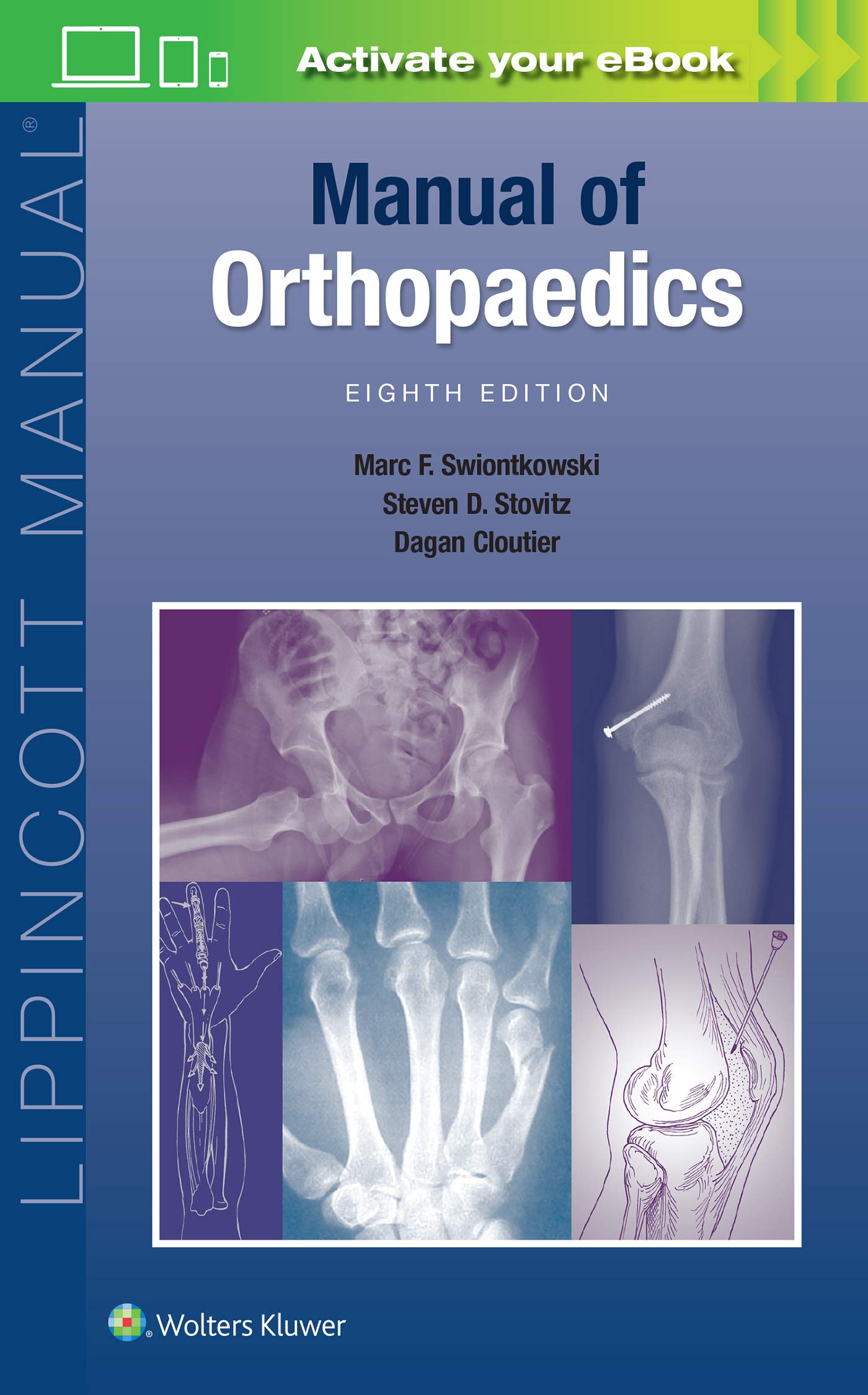 Manual of Orthopaedics (Lippincott Manual Series)-ISBN: 9781975143350