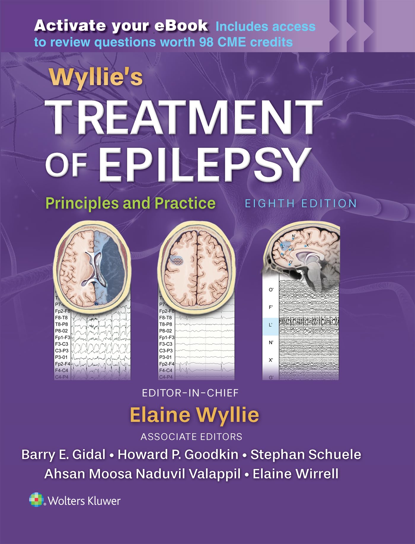 Wyllie's Treatment of Epilepsy: Print + eBook with Multimedia: Principles and Practice-ISBN: 9781975218096