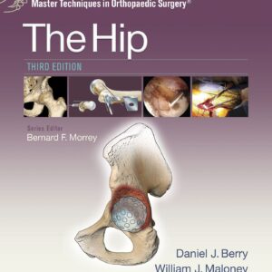 Master Techniques in Orthopaedic Surgery: The Hip-ISBN: 9781451194029
