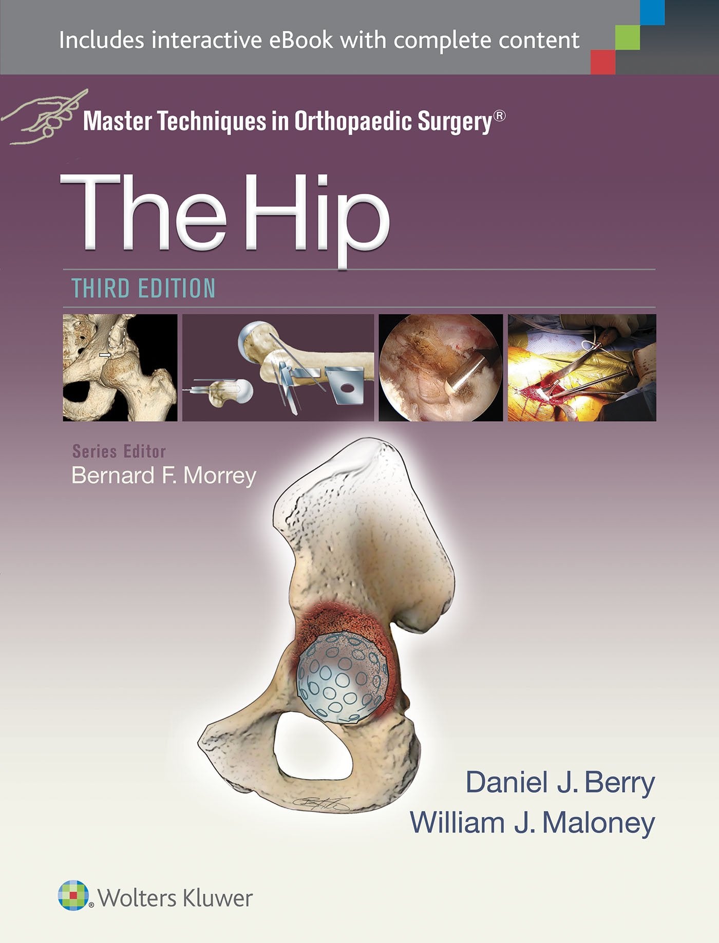 Master Techniques in Orthopaedic Surgery: The Hip-ISBN: 9781451194029