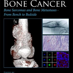 Bone Cancer: Bone Sarcomas and Bone Metastases - From Bench to Bedside