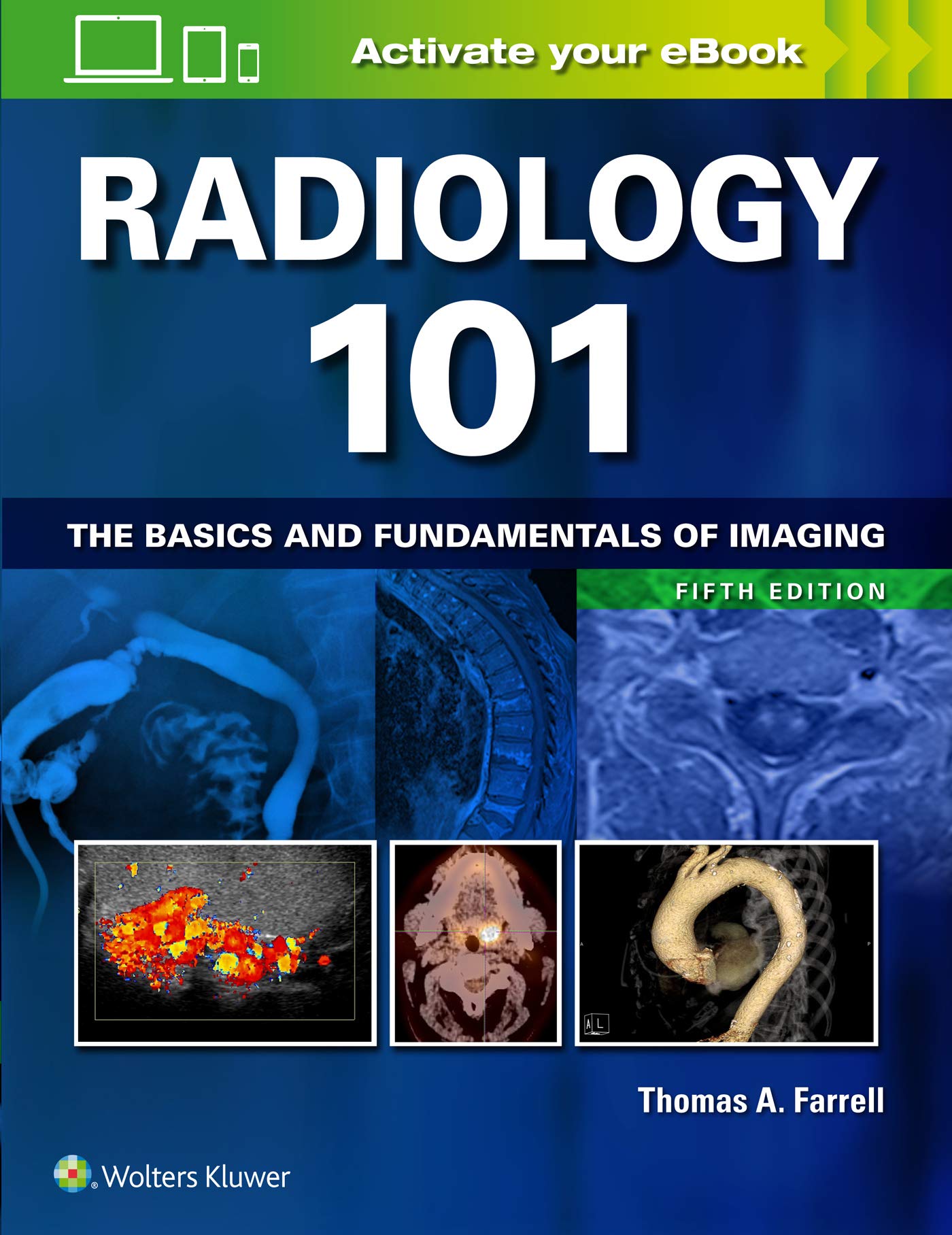 Radiology 101: The Basics and Fundamentals of Imaging-ISBN: 9781496392985