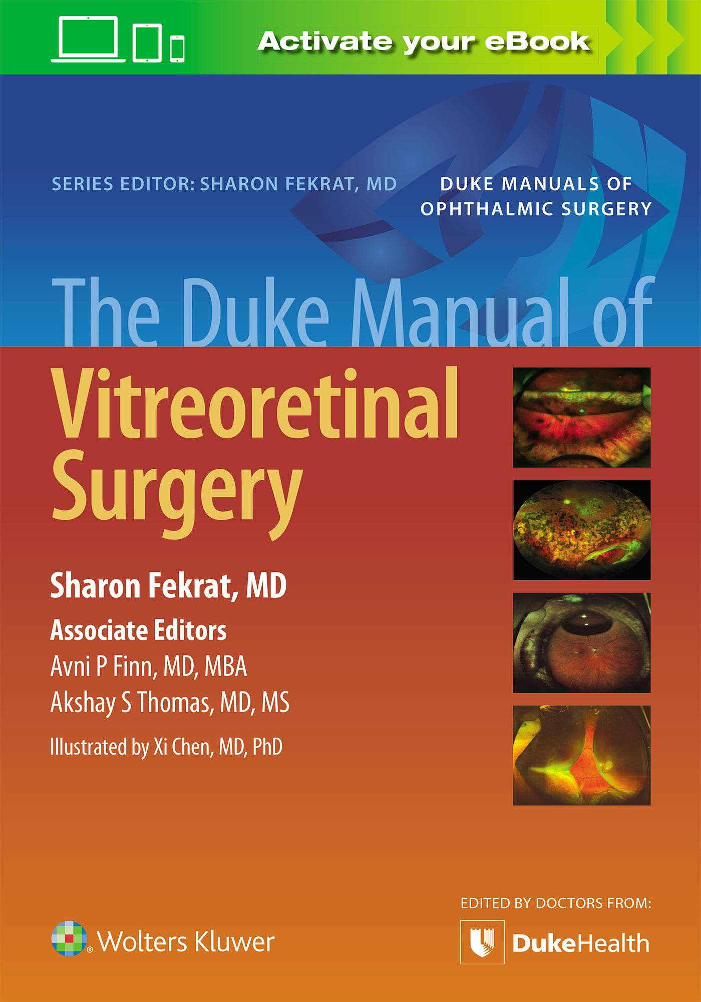 The Duke Manual of Vitreoretinal Surgery-ISBN: 9781975117900