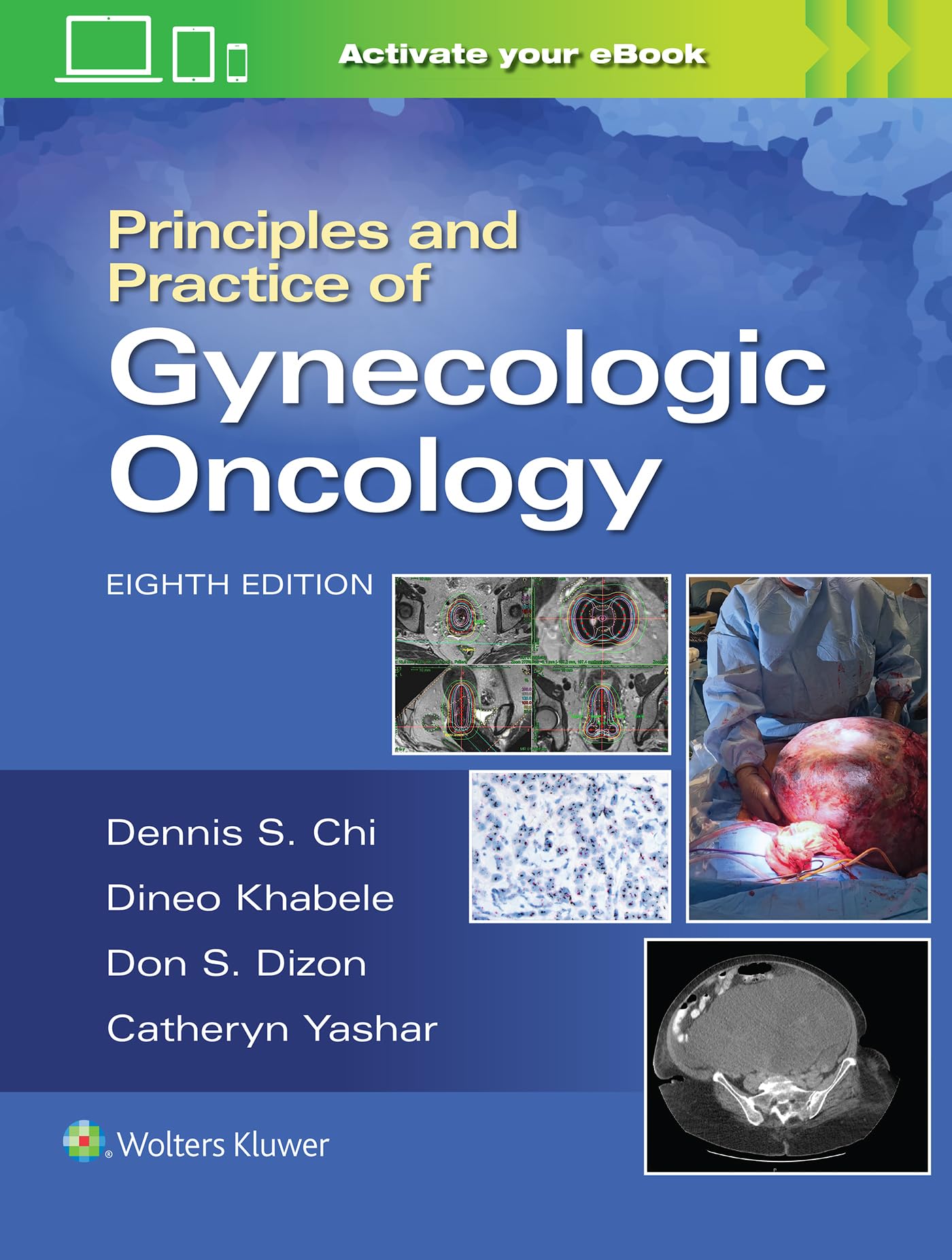 Principles and Practice of Gynecologic Oncology-ISBN: 9781975183271