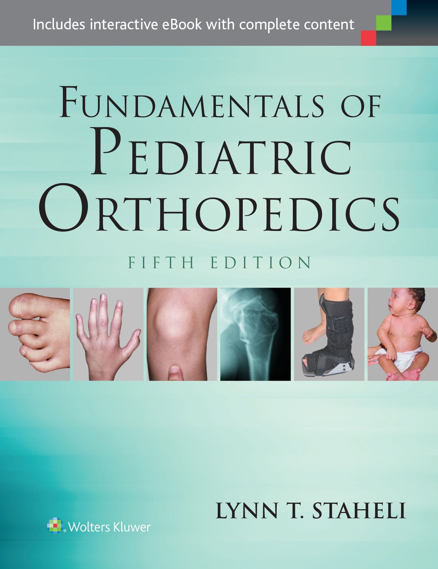 Fundamentals of Pediatric Orthopedics-ISBN: 9781451193930