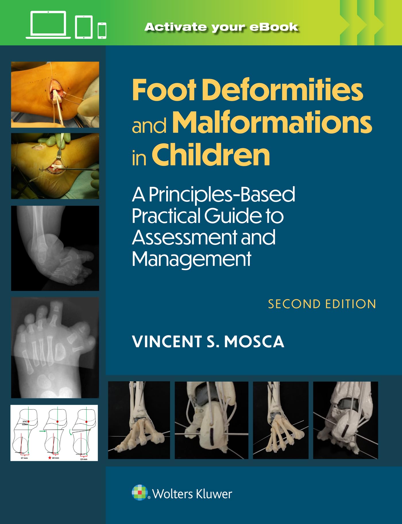 Foot Deformities and Malformations in Children: A Principles-Based