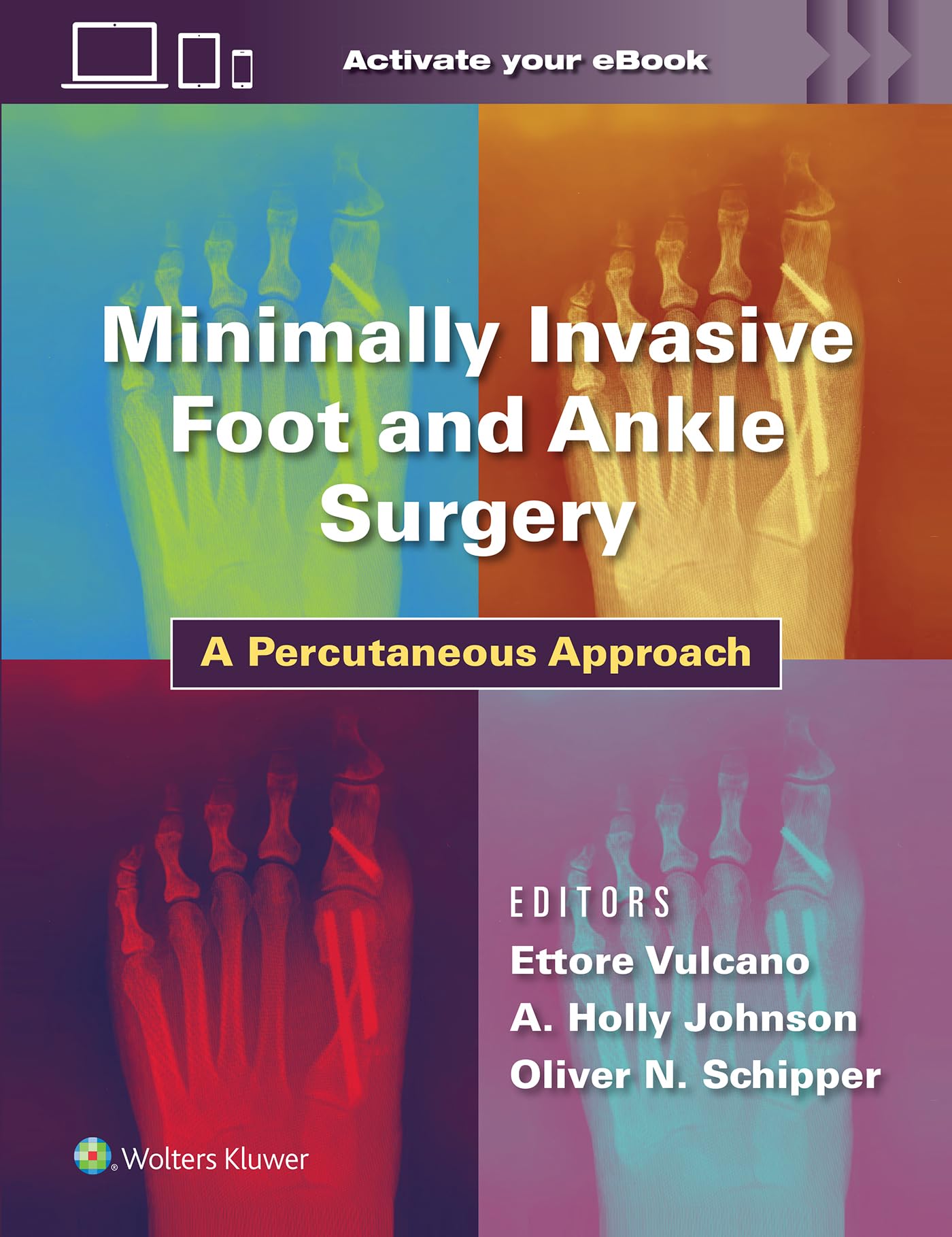 Minimally Invasive Foot and Ankle Surgery: A Percutaneous Approach-ISBN: 9781975198701