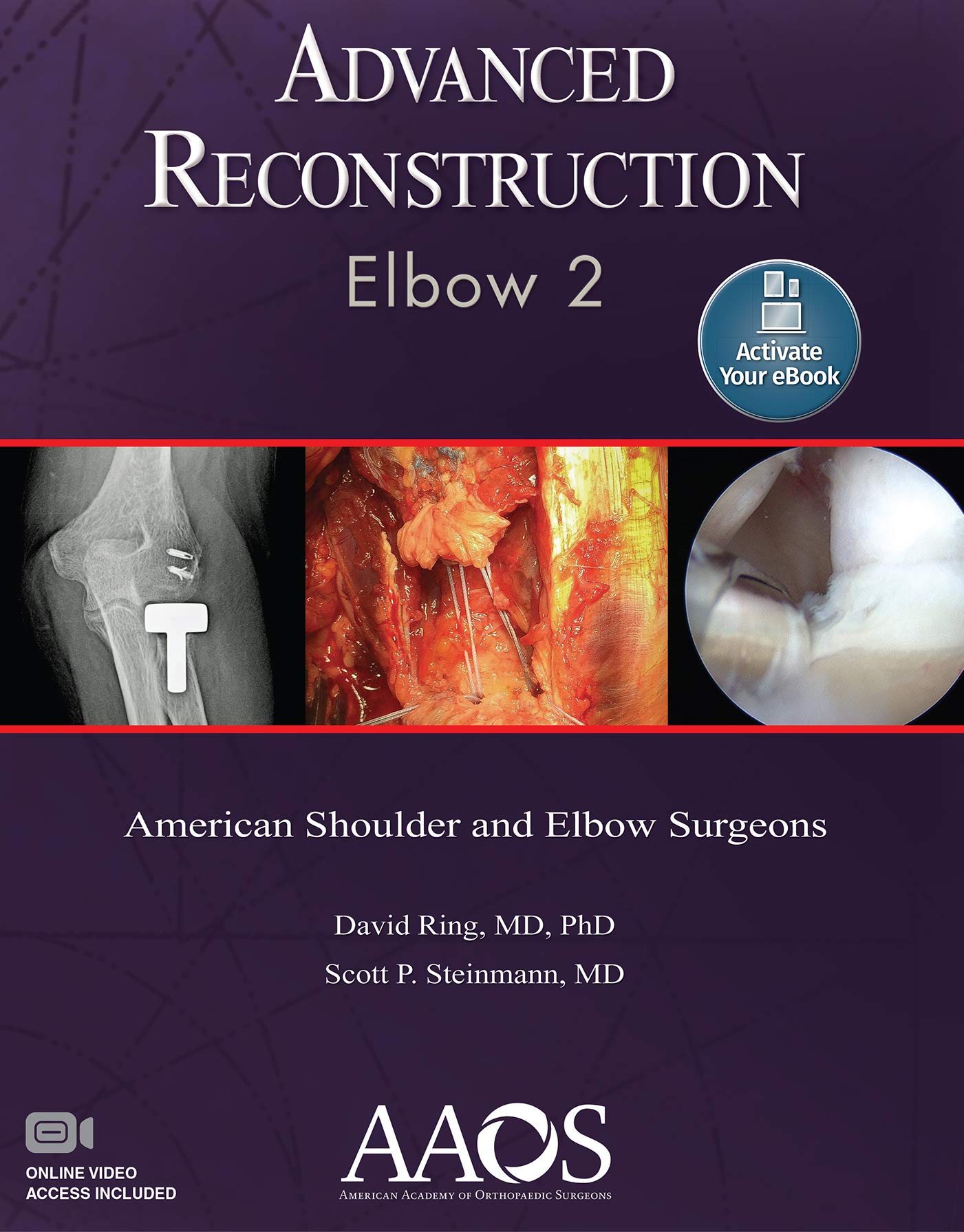 Advanced Reconstruction: Elbow 2: Print + Ebook with Multimedia (AAOS - American Academy of Orthopaedic Surgeons)-ISBN: 9781975123437