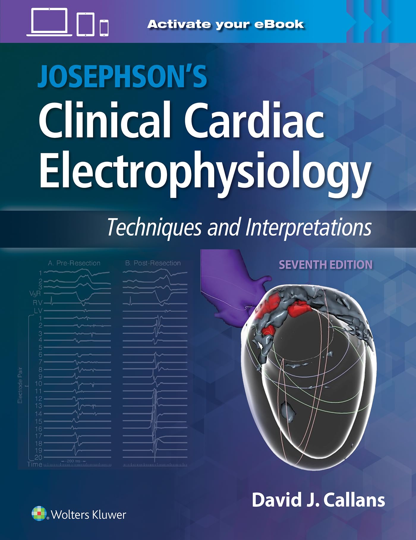Josephson's Clinical Cardiac Electrophysiology: Techniques and Interpretations-ISBN: 9781975201166