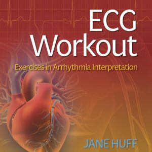 ECG Workout: Exercises in Arrhythmia Interpretation-ISBN: 9781975174545